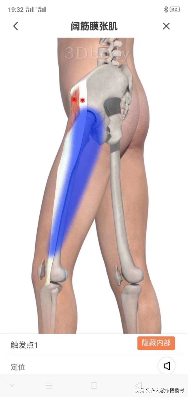 肌肉起止点,肌肉起止点松解