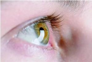 糖尿病飞蚊症闪光眼底出血,飞蚊症是糖尿病导致的吗