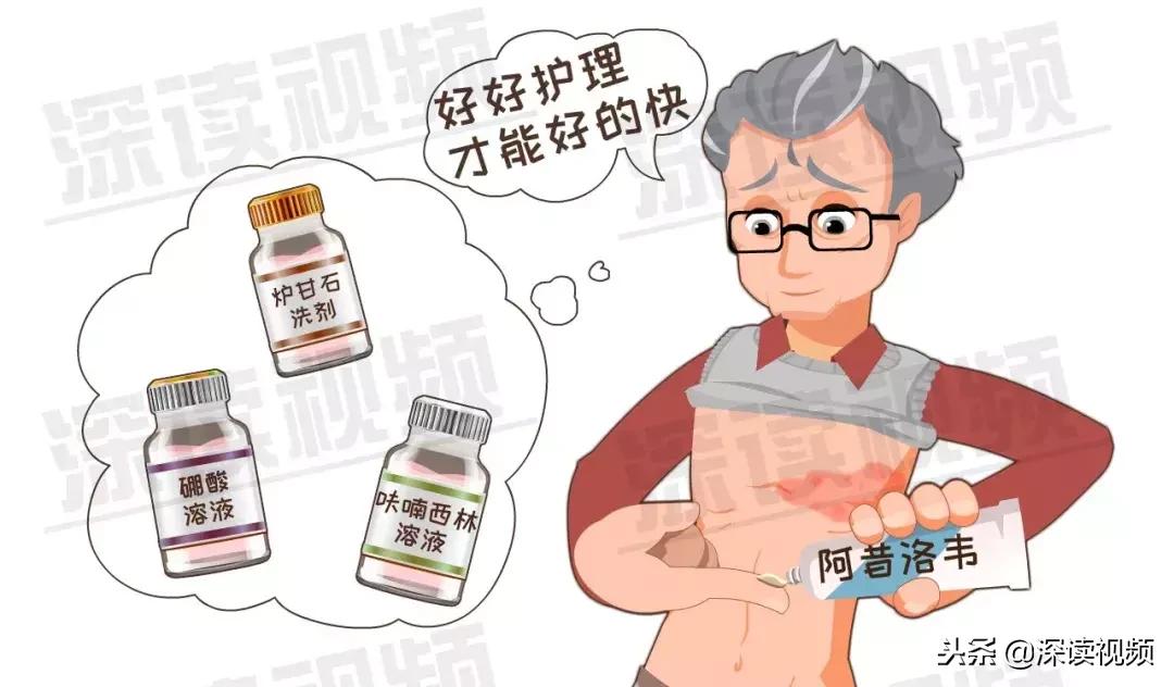 带状疱疹疫苗得了后能打吗,带状疱疹疫苗都可以打吗