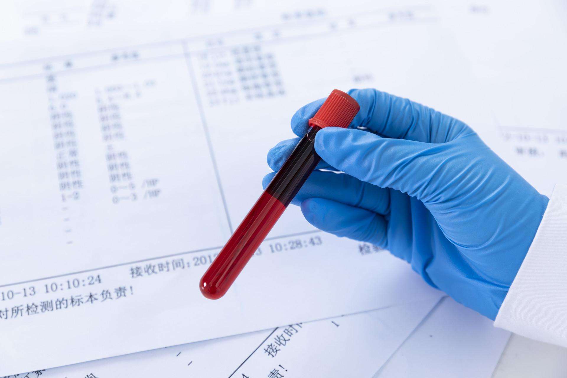 糖化血红蛋白7.1饮食怎么控制,糖化血红蛋白6.7该怎么控制饮食