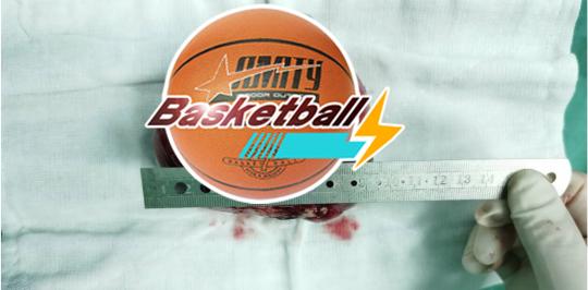 4岁小孩得肾母细胞肿瘤,什么样的宝宝容易得肾母细胞瘤