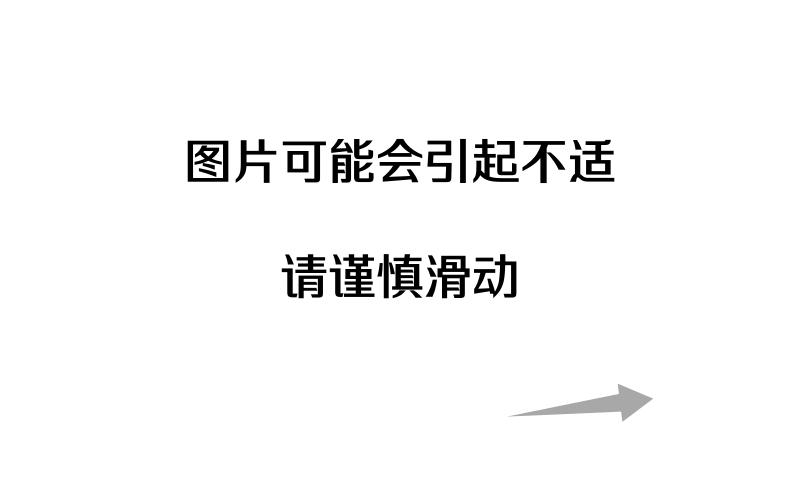 太原中心医院骨科汾东一病区完成首例ilizarov外固定矫形高弓足