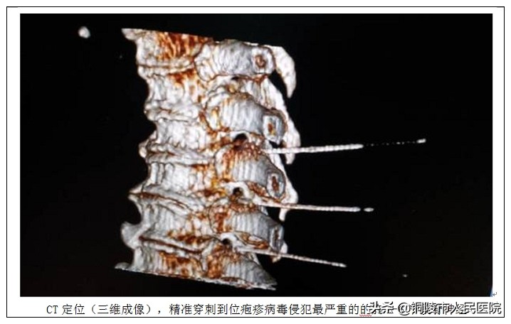 市人民医院医学影像科,德州市人民医院微创介入中心