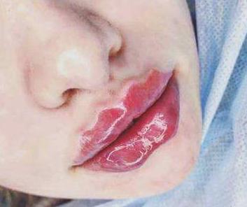 防止嘴唇脱皮的滋润唇膏哪种好用,嘴唇干裂脱皮哪种唇膏好得快