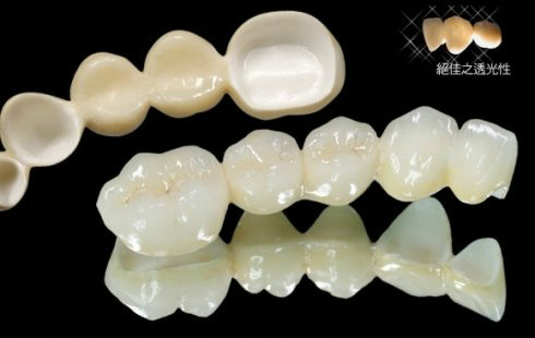 假牙最便宜一颗多少钱,假牙最贵