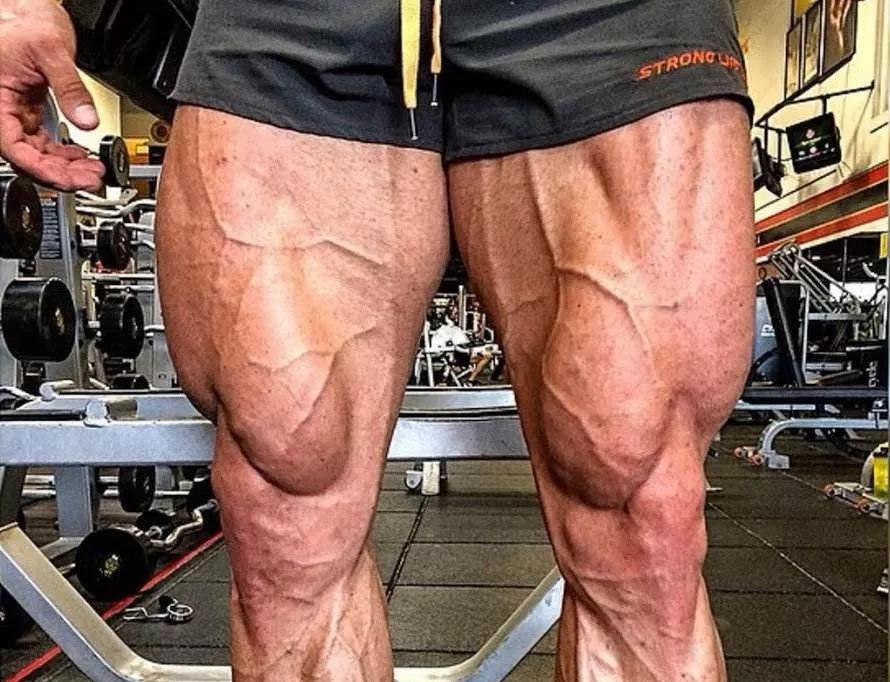 改善腿型的腿部运动,腿部拉伸矫正xo型腿