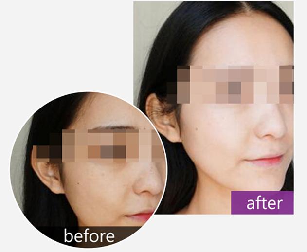 干干的发质怎么改善,干得起皮了怎么办