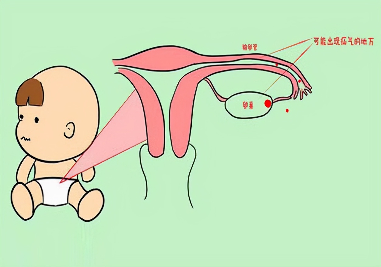 小儿疝气一般怎么引起的,小儿疝气怎么缓解