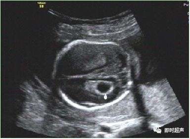 产科常规彩色超声报告单介绍,常见妇科疾病超声报告