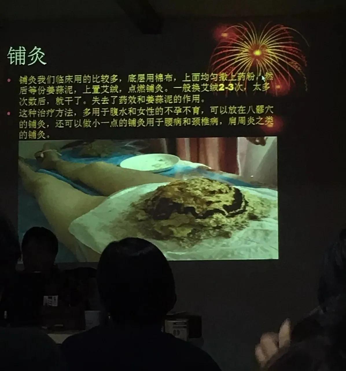 北京艾灸经络推拿培训,艾灸培训有感