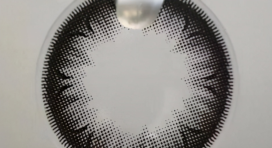 儿童角膜溃疡严重会穿孔吗,儿童角膜溃疡