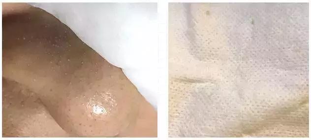 护肤反而皮肤差,改掉这些护肤恶习让你越变越美丽