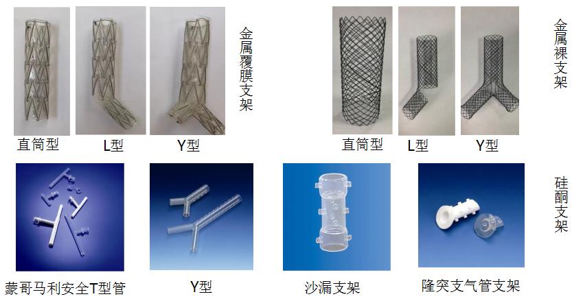 支气管镜高频电刀治疗中央型肺癌,支气管镜在早期肺癌诊断的意义