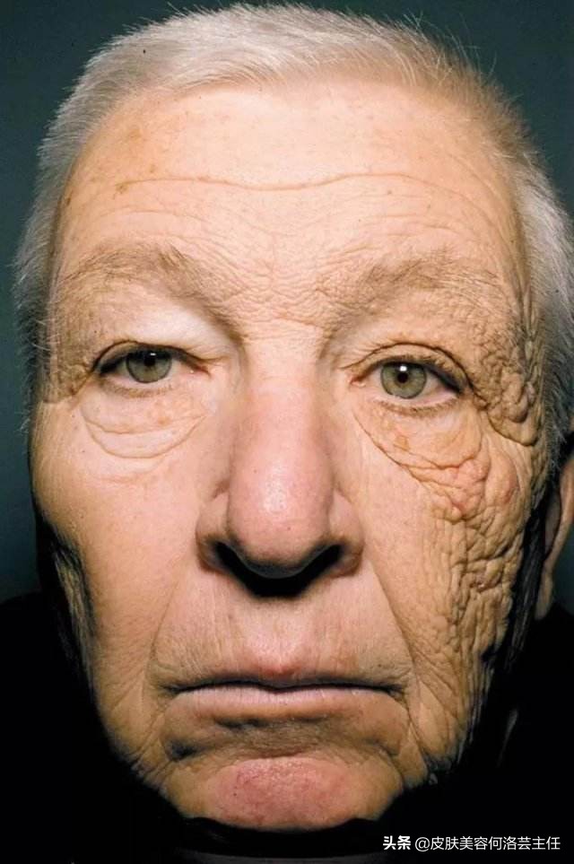 脸上出现皱纹，我老了？5个皱纹产生的原因，别再视而不见