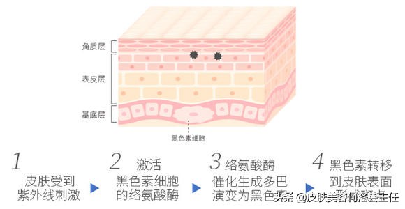 脸上有黑色素沉着斑怎能治好,脸上有色斑的护肤教程