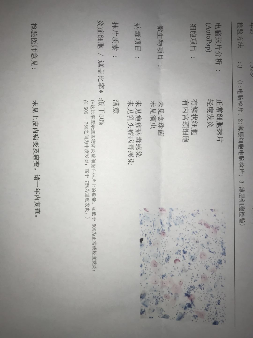 反复霉菌性阴道炎总不好，你会如何应对？来看医生的现身方法吧