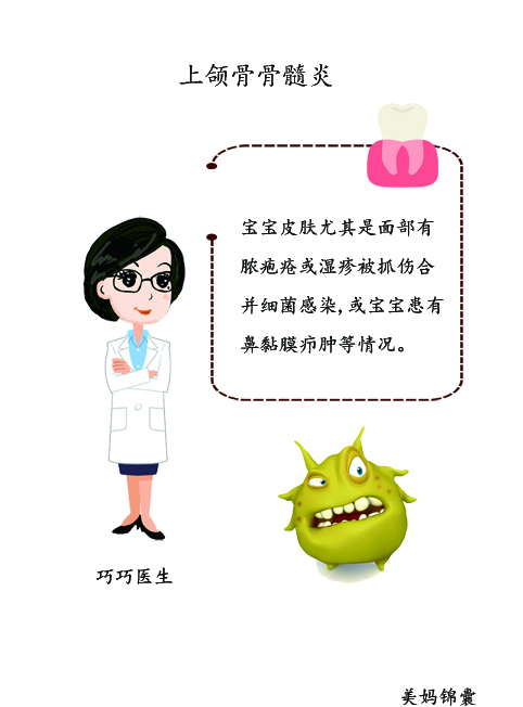 婴幼儿上颌骨骨髓炎最常见并发症,骨髓炎是怎么引起的儿童