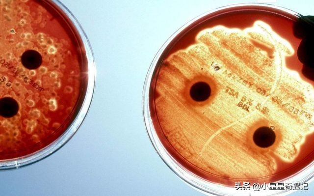 人类死之后身体会发生哪些变化,人类死亡后血液去哪了