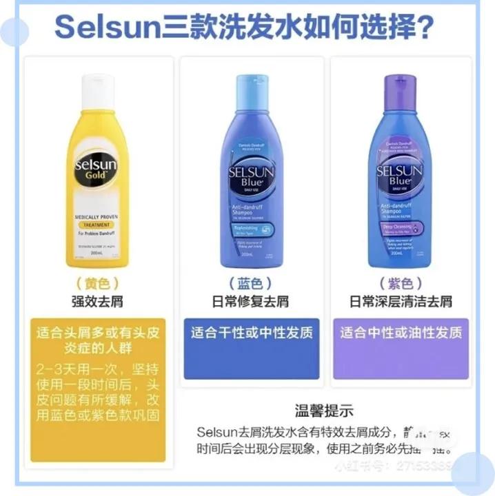 鞠婧祎全身造假,鞠婧祎头皮都整了吗