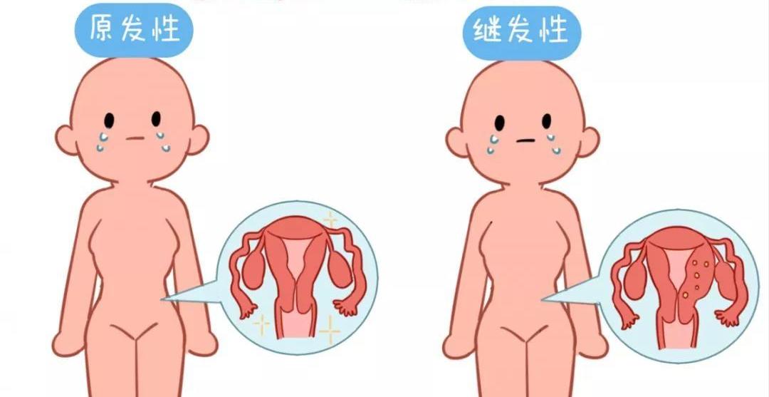 关于痛经的治疗方式惊呆一整年,痛经在治疗期间容易有什么误区