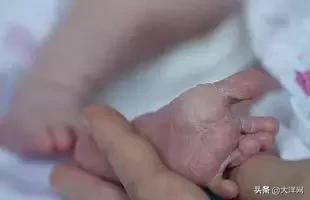 三岁小孩手上起红疹,三岁男童手上反复起皮