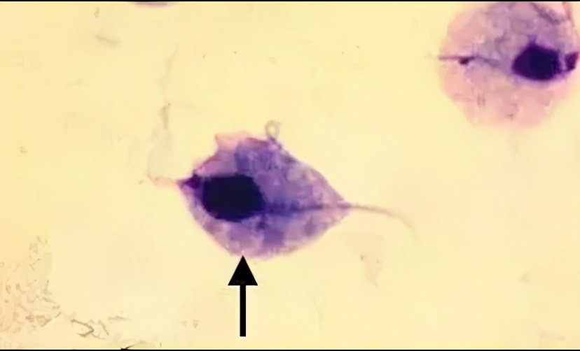 检查身体有没有虫怎么检查,身上有小黑点点一样的虫子
