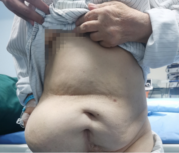 30岁右侧腹部隐痛十多年,右下腹胀气20年怎么回事后背胀