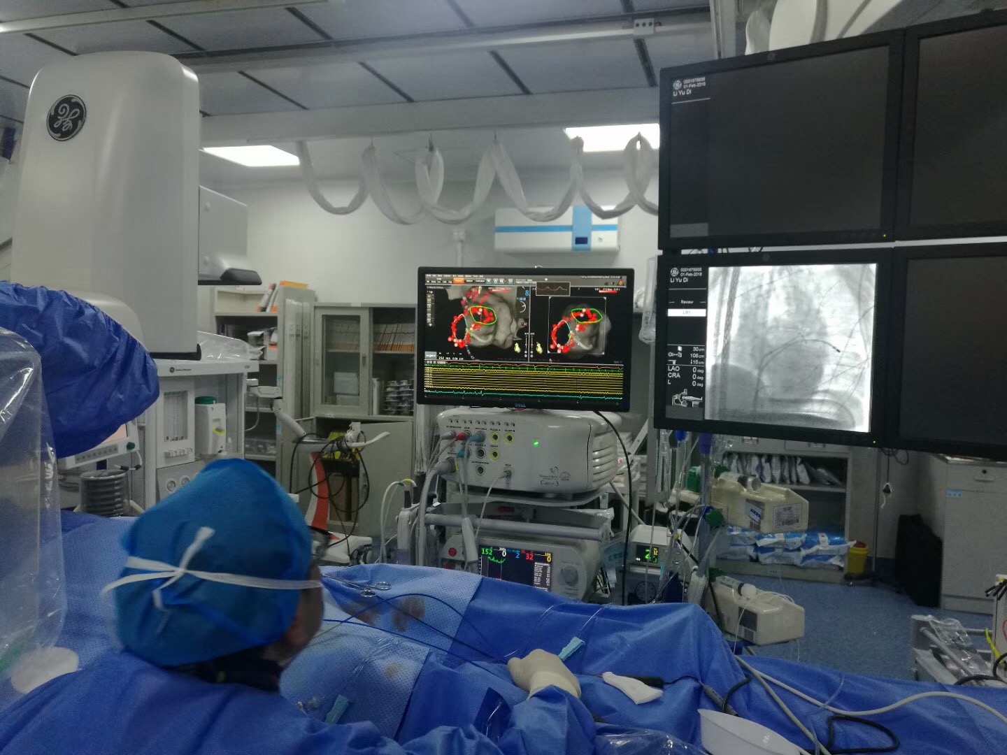 抗心律失常药教学视频,心律失常吃哪种药好