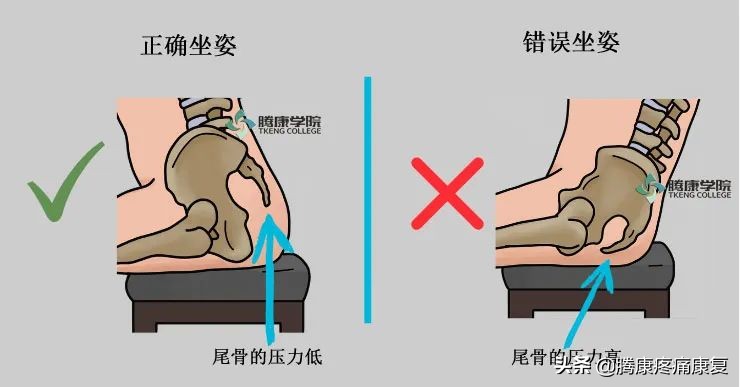 久睡尾骨疼痛最快缓解方法,四个缓解尾骨疼痛的方法