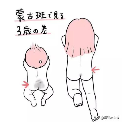 如何预防宝宝进幼儿园传染生病,新生儿宝宝如何护理常识
