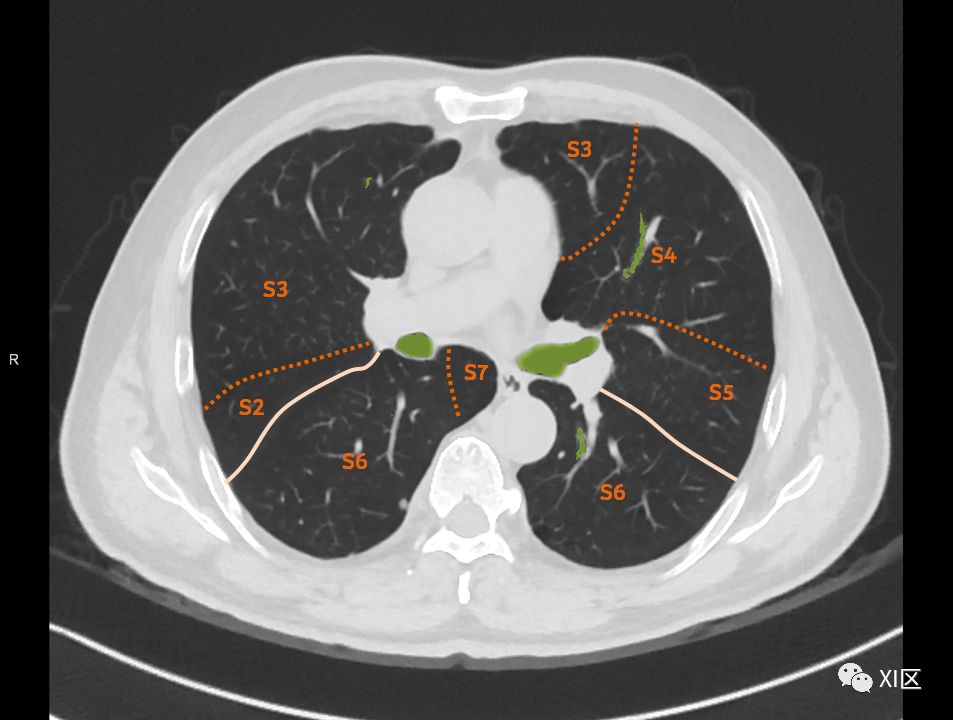 如此详细的肺部影像解剖，有点儿酷！