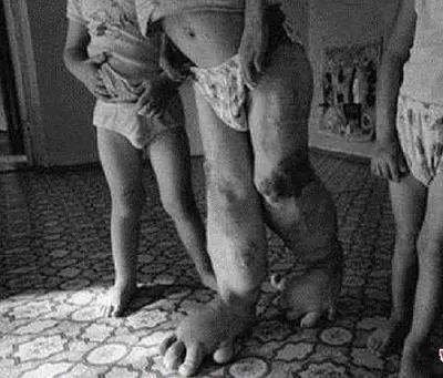 切尔诺贝利事件辐射有多强,辐射剂量切尔诺贝利