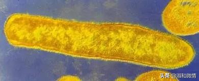 甲硝唑片的说明书用量看不懂,甲硝唑片的适应证有哪些