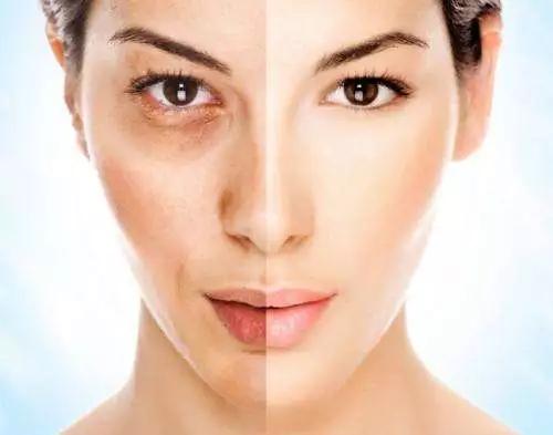 去角质搓出来的真的是脏东西吗,去角质搓出泥是真的假的