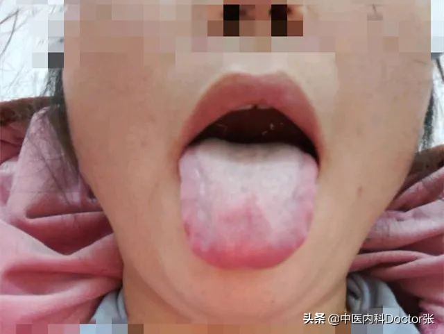 枳实理中汤治疗各种便秘,中药枳实治疗腹胀便秘