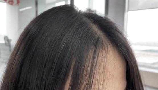 叹头部SPA！拒做人间“油”物，解锁防秃养发小妙招