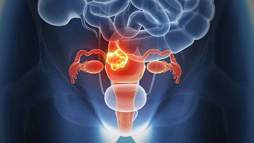 一些妇科问题,妇科疾病哪几种比较严重