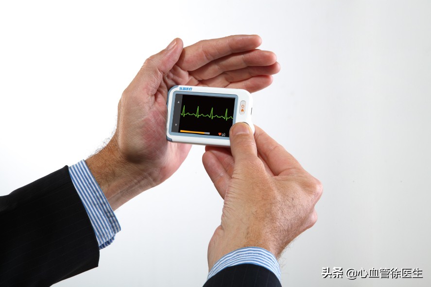 心脏有早搏需要查什么,心脏早搏有点心慌不舒服