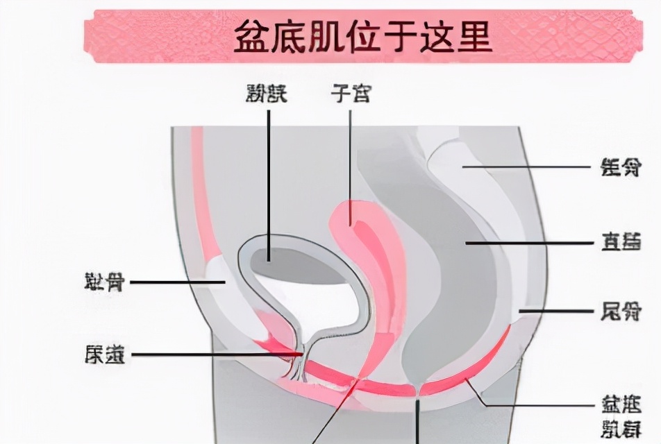 盆底肌修复是用什么部位发力,盆底肌不懂得放松