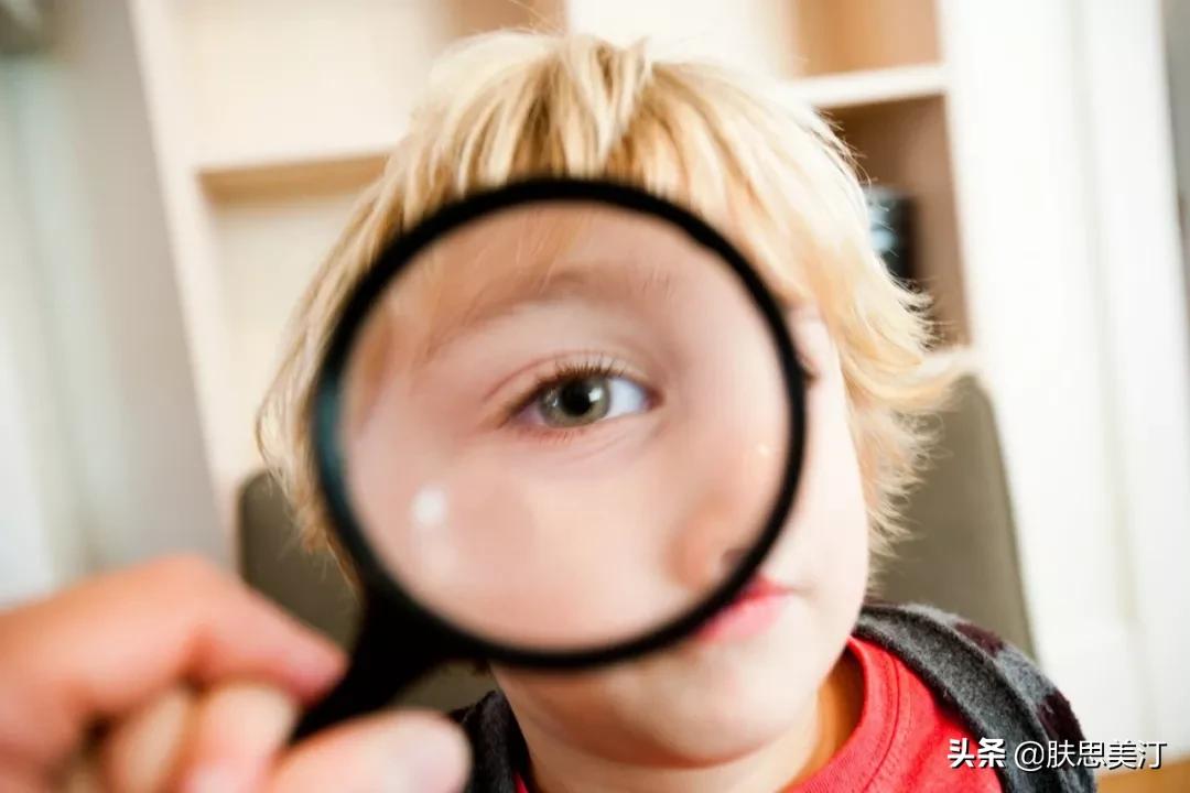 只有胖人才长脂肪粒吗,长了个很凸起的脂肪粒