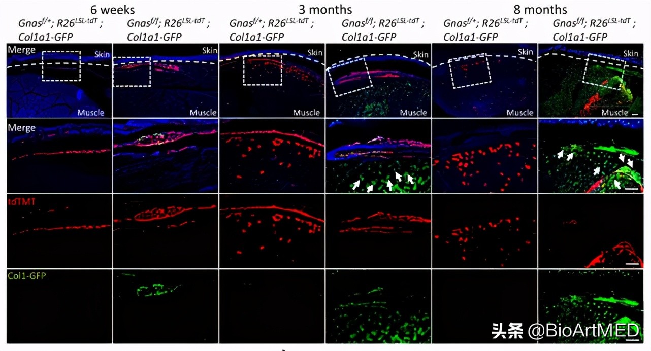 进展|哈佛华人教授团队揭示异位骨化形成及扩展的新机制​