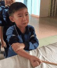 胳膊上莫名其妙的长疤怎么来的,胳膊上的疤是怎么来的