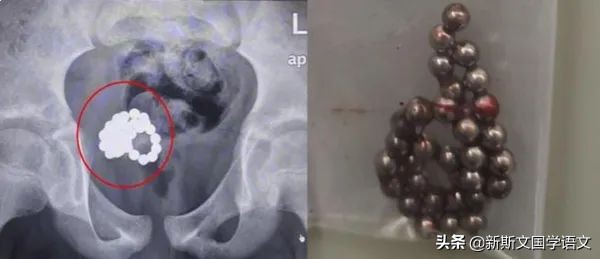 学校是否应该给孩子们提供性教育,学校开展性教育的坏处