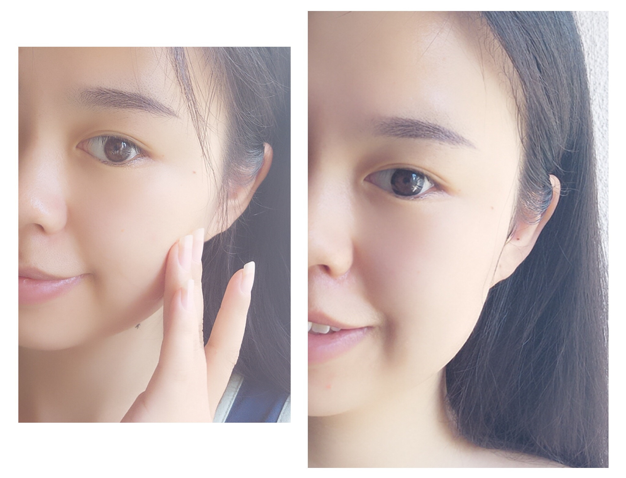 秋天皮肤过敏怎么补水,皮肤过敏还太干燥补水最好的方法