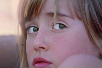 如何区分脸上色斑类型图片,如何辨别面部的各种斑