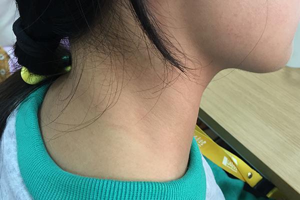 总是感觉后背疼痛酸胀是怎么回事,总感觉后背酸痛是怎么回事