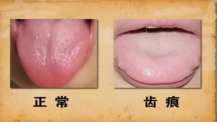 止咳化痰而不引起腹泻的中草药,对腹泻有好处的中药