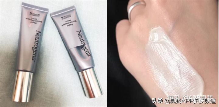 脸上毛周角化长闭口怎么办,毛周角化和粉刺有什么区别