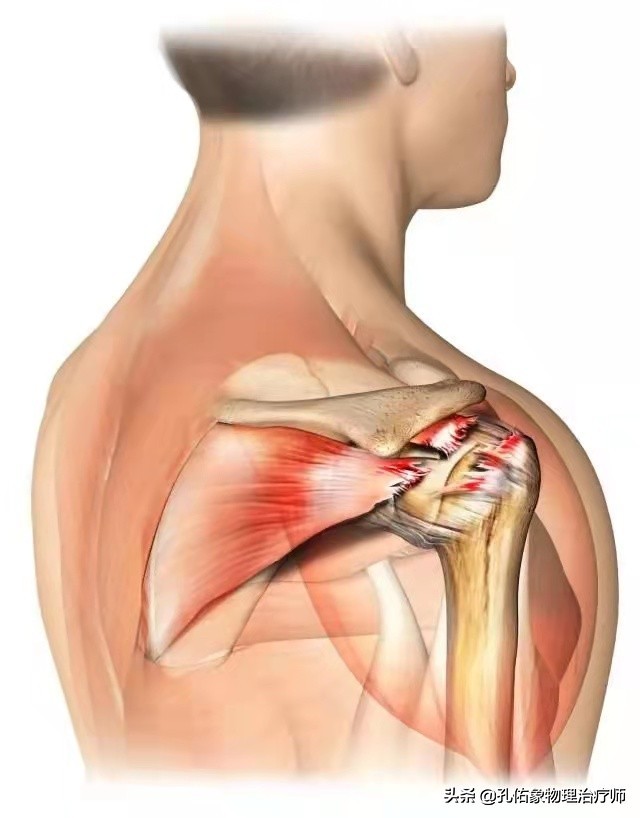 肩膀痛不知什么原因,教你一个动作解决肩膀疼痛