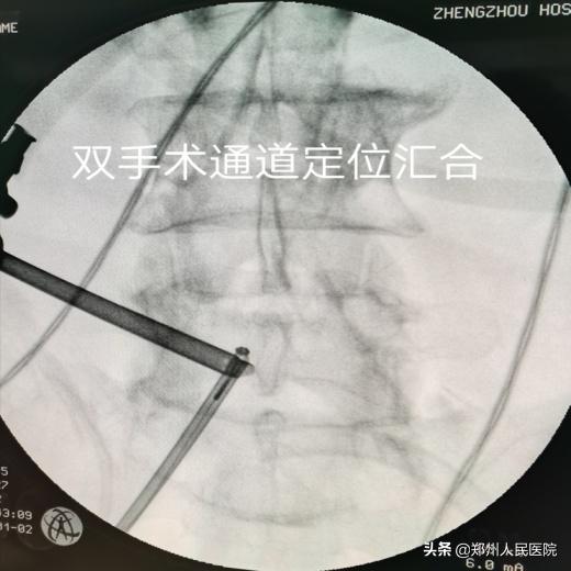 对骨科微创技术的认识,骨科手术与保守治疗对比